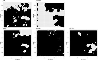 Geographically weighted linear combination test for gene-set analysis of a continuous spatial phenotype as applied to intratumor heterogeneity